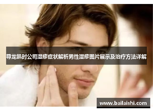 尊龙凯时公司湿疹症状解析男性湿疹图片展示及治疗方法详解